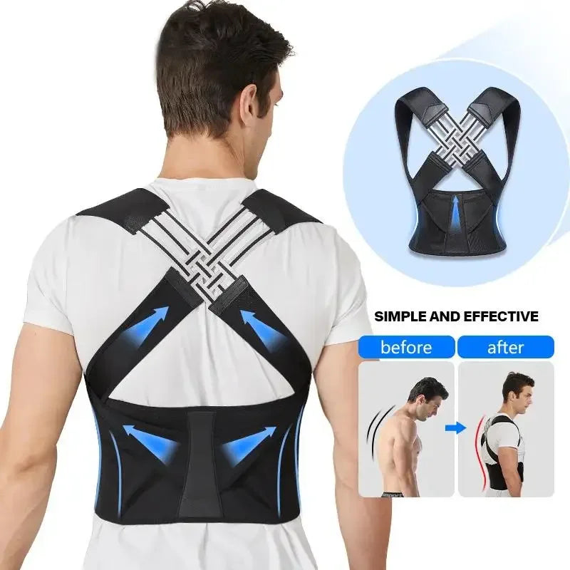Posture Corrector | Adjustable Back Support Belt